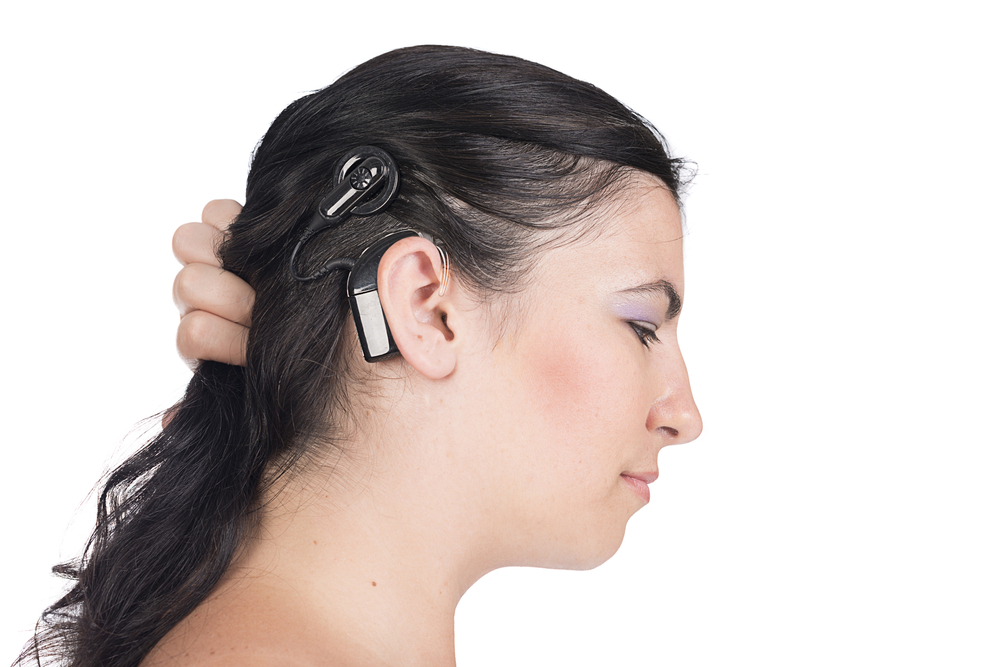 The History of the Cochlear Implant