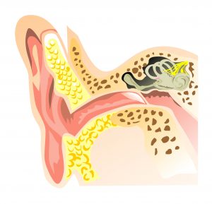 Types of hearing loss