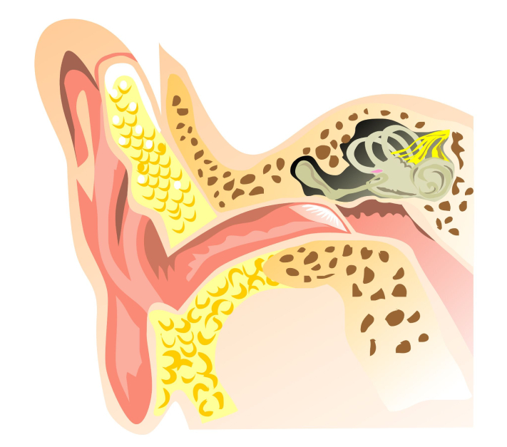 Types of Hearing Loss